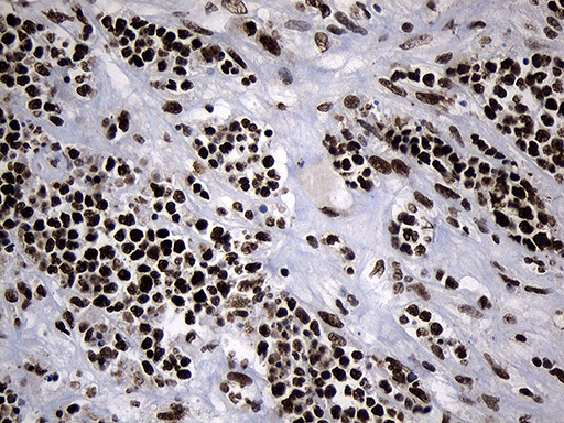 POLR2A Antibody in Immunohistochemistry (Paraffin) (IHC (P))