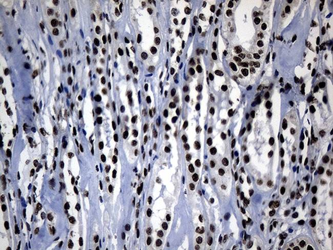 POLR2A Antibody in Immunohistochemistry (Paraffin) (IHC (P))