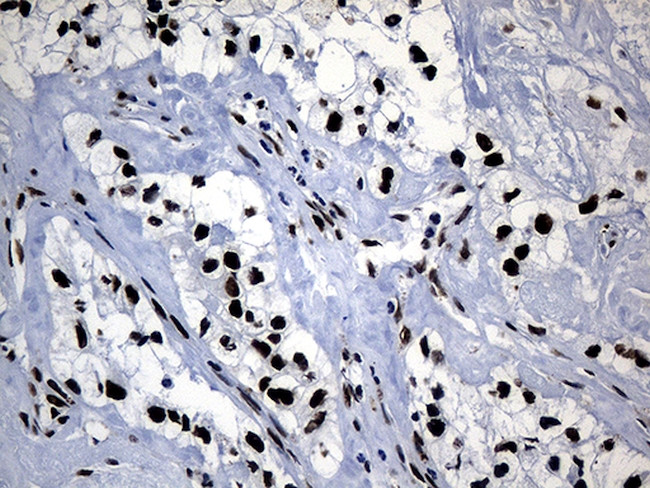 POLR2A Antibody in Immunohistochemistry (Paraffin) (IHC (P))