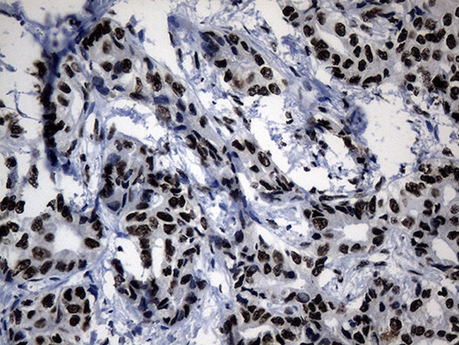 POLR2A Antibody in Immunohistochemistry (Paraffin) (IHC (P))