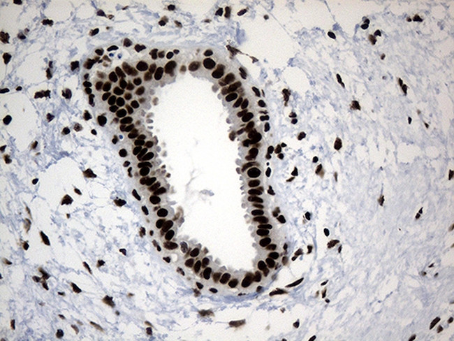 POLR2A Antibody in Immunohistochemistry (Paraffin) (IHC (P))