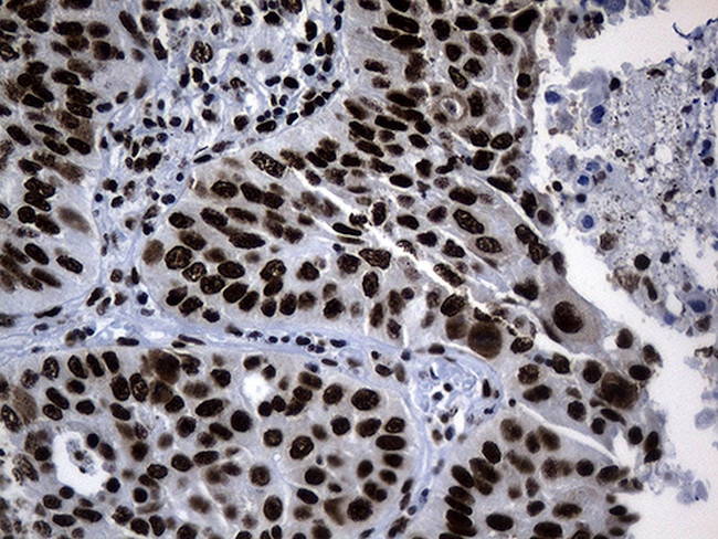 POLR2A Antibody in Immunohistochemistry (Paraffin) (IHC (P))