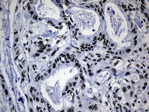 POLR2A Antibody in Immunohistochemistry (Paraffin) (IHC (P))