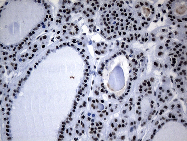 POLR2A Antibody in Immunohistochemistry (Paraffin) (IHC (P))