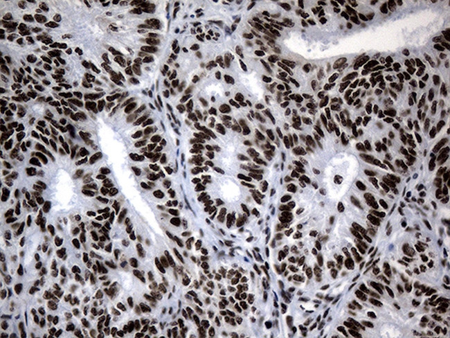 POLR2A Antibody in Immunohistochemistry (Paraffin) (IHC (P))