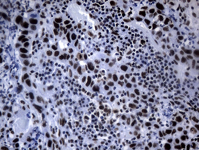 POLR2A Antibody in Immunohistochemistry (Paraffin) (IHC (P))