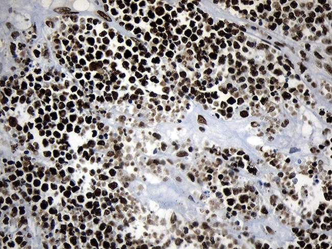 POLR2A Antibody in Immunohistochemistry (Paraffin) (IHC (P))