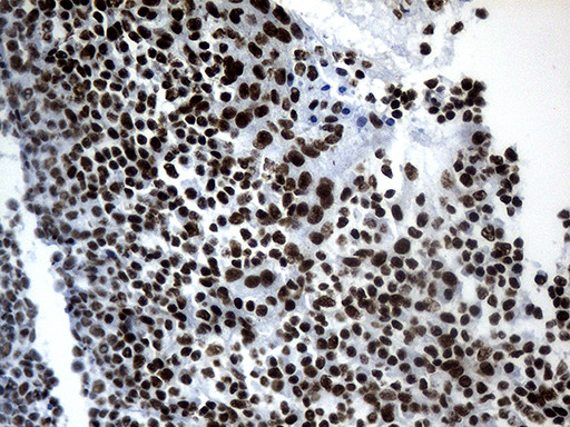 POLR2A Antibody in Immunohistochemistry (Paraffin) (IHC (P))