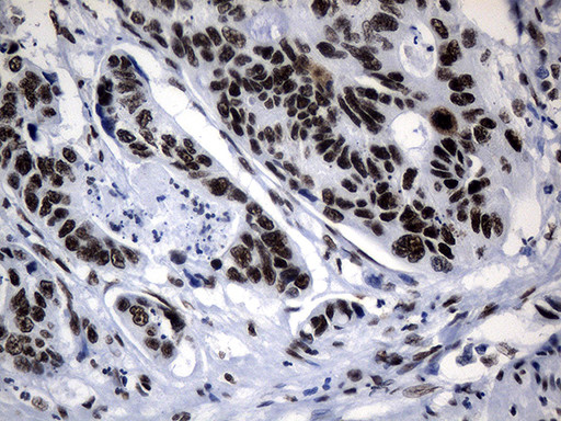 POLR2A Antibody in Immunohistochemistry (Paraffin) (IHC (P))