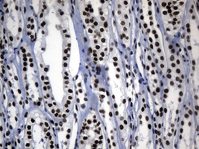 POLR2A Antibody in Immunohistochemistry (Paraffin) (IHC (P))