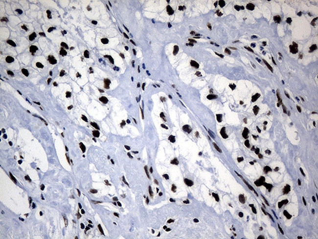 POLR2A Antibody in Immunohistochemistry (Paraffin) (IHC (P))