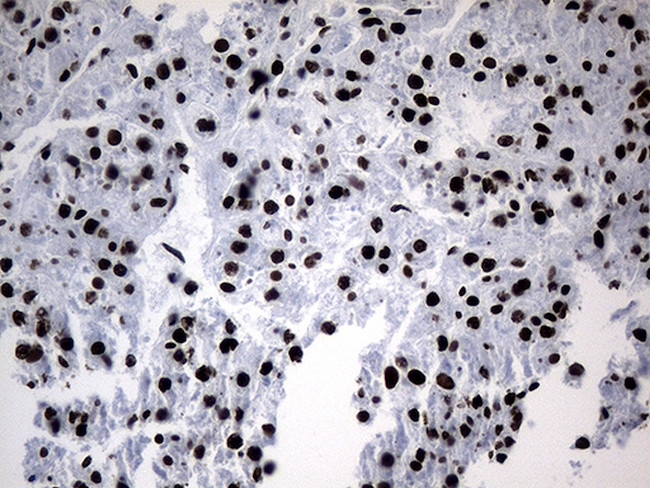 POLR2A Antibody in Immunohistochemistry (Paraffin) (IHC (P))