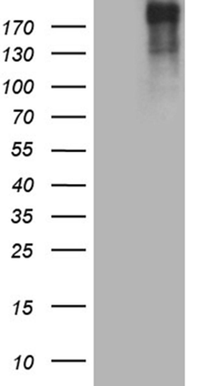 POLR2A Antibody in Western Blot (WB)