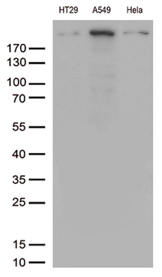 POLR2A Antibody in Western Blot (WB)