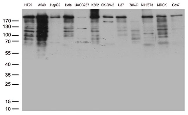 POLR2A Antibody in Western Blot (WB)