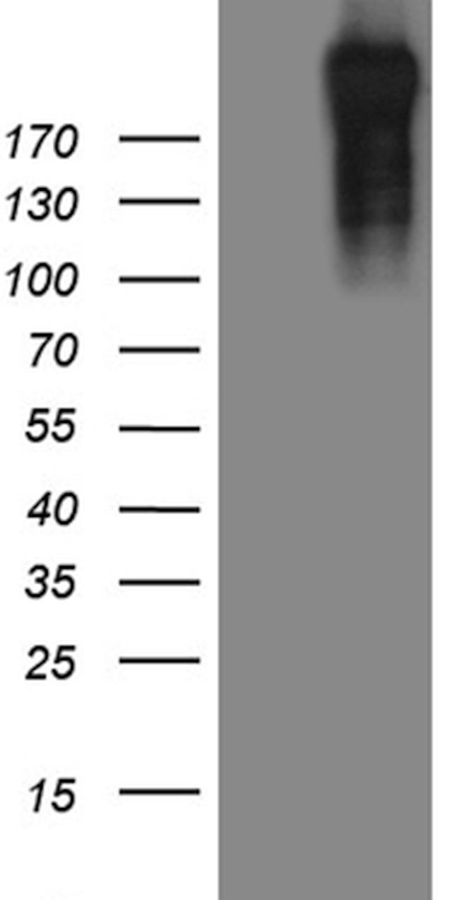 POLR2A Antibody in Western Blot (WB)