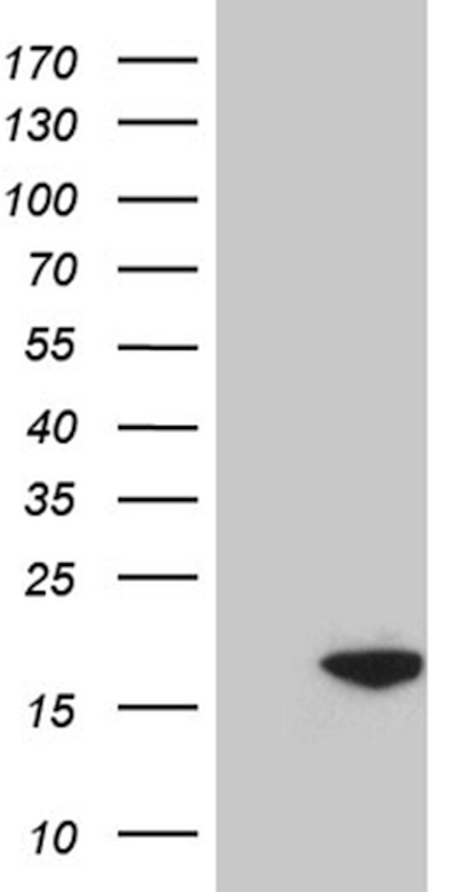 POLR2J Antibody in Western Blot (WB)