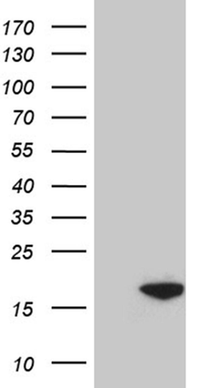 POLR2J Antibody in Western Blot (WB)