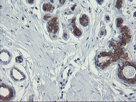 POLR3C Antibody in Immunohistochemistry (Paraffin) (IHC (P))