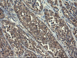 POLR3C Antibody in Immunohistochemistry (Paraffin) (IHC (P))