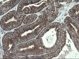 POLR3C Antibody in Immunohistochemistry (Paraffin) (IHC (P))