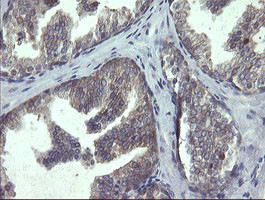 POLR3C Antibody in Immunohistochemistry (Paraffin) (IHC (P))