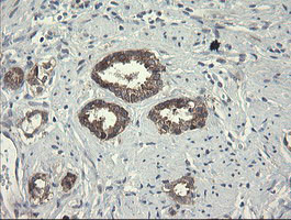 POLR3C Antibody in Immunohistochemistry (Paraffin) (IHC (P))