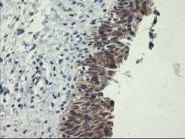 POLR3C Antibody in Immunohistochemistry (Paraffin) (IHC (P))