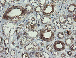 POLR3C Antibody in Immunohistochemistry (Paraffin) (IHC (P))