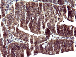 POLR3GL Antibody in Immunohistochemistry (Paraffin) (IHC (P))