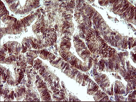 POLR3GL Antibody in Immunohistochemistry (Paraffin) (IHC (P))