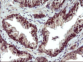 POLR3GL Antibody in Immunohistochemistry (Paraffin) (IHC (P))