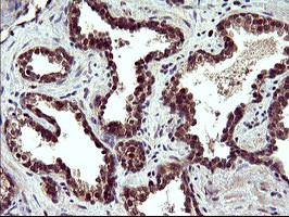 POLR3GL Antibody in Immunohistochemistry (Paraffin) (IHC (P))