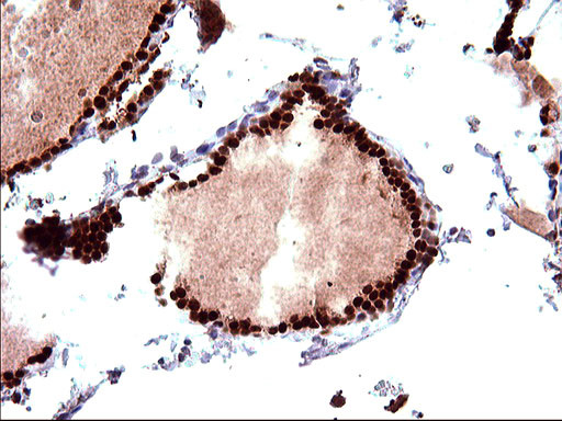 POLR3GL Antibody in Immunohistochemistry (Paraffin) (IHC (P))