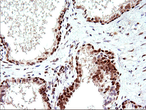 POLR3GL Antibody in Immunohistochemistry (Paraffin) (IHC (P))