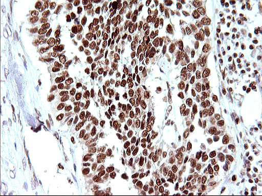 POLR3GL Antibody in Immunohistochemistry (Paraffin) (IHC (P))