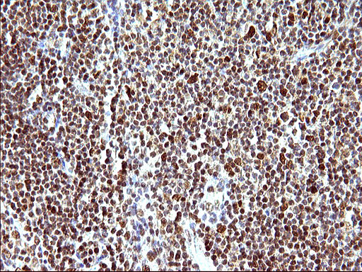 POLR3GL Antibody in Immunohistochemistry (Paraffin) (IHC (P))