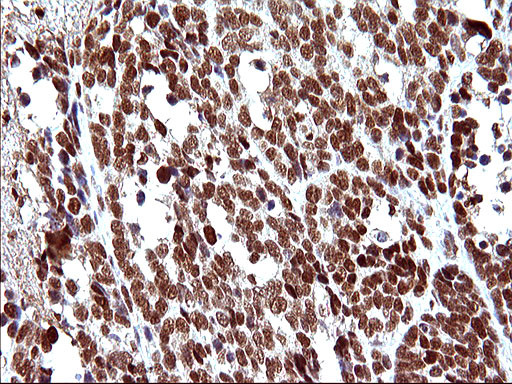 POLR3GL Antibody in Immunohistochemistry (Paraffin) (IHC (P))