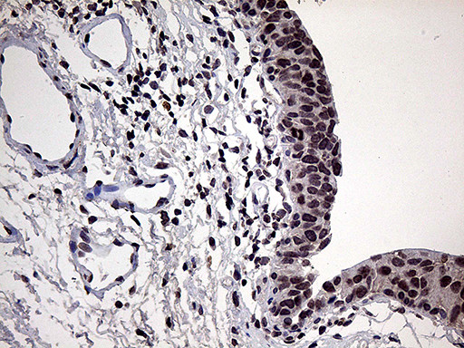 POLR3H Antibody in Immunohistochemistry (Paraffin) (IHC (P))