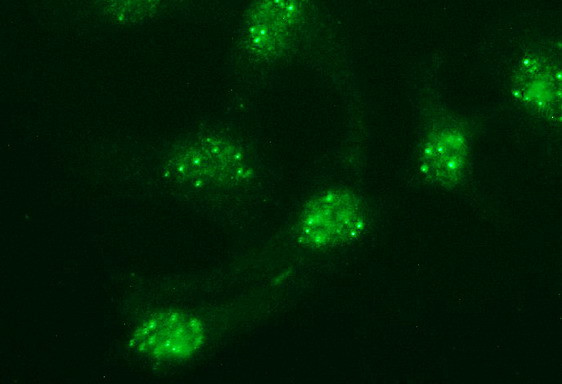 POMC Antibody in Immunocytochemistry (ICC/IF)