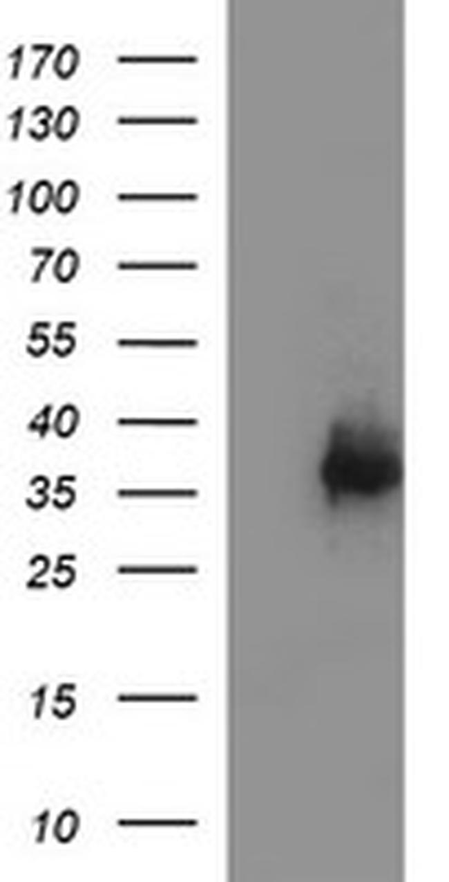 POMC Antibody in Western Blot (WB)