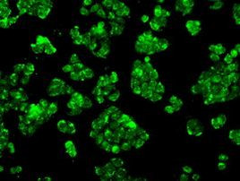 POR Antibody in Immunocytochemistry (ICC/IF)