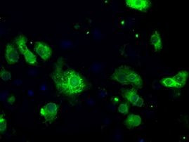 POR Antibody in Immunocytochemistry (ICC/IF)