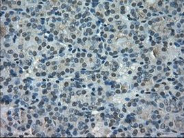 POR Antibody in Immunohistochemistry (Paraffin) (IHC (P))