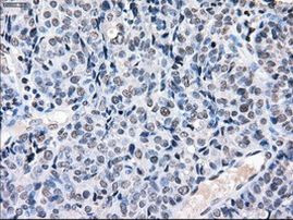 POR Antibody in Immunohistochemistry (Paraffin) (IHC (P))