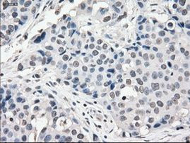 POR Antibody in Immunohistochemistry (Paraffin) (IHC (P))