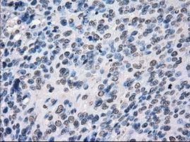 POR Antibody in Immunohistochemistry (Paraffin) (IHC (P))