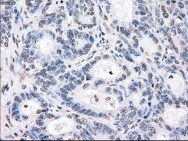 POR Antibody in Immunohistochemistry (Paraffin) (IHC (P))