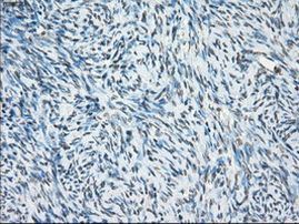 POR Antibody in Immunohistochemistry (Paraffin) (IHC (P))