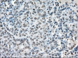 POR Antibody in Immunohistochemistry (Paraffin) (IHC (P))